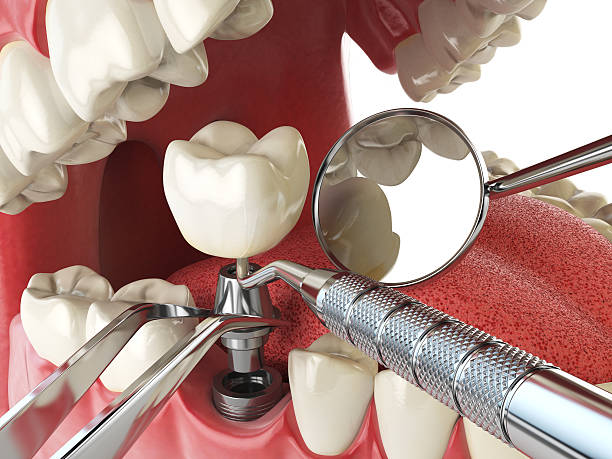 Best Emergency Treatment for Toothache in Westmont, IL